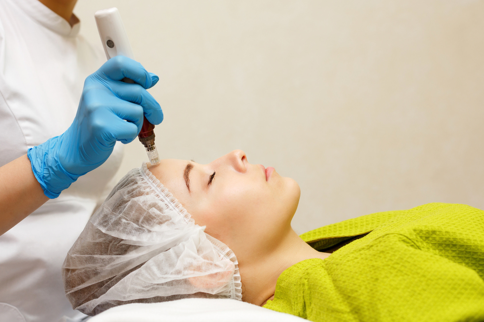 Microneedling