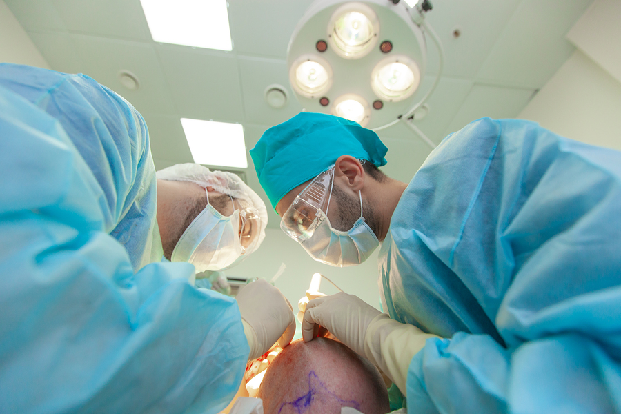 Die zweite Haartransplantation zur Verdichtung sorgt für perfekte Ergebnisse