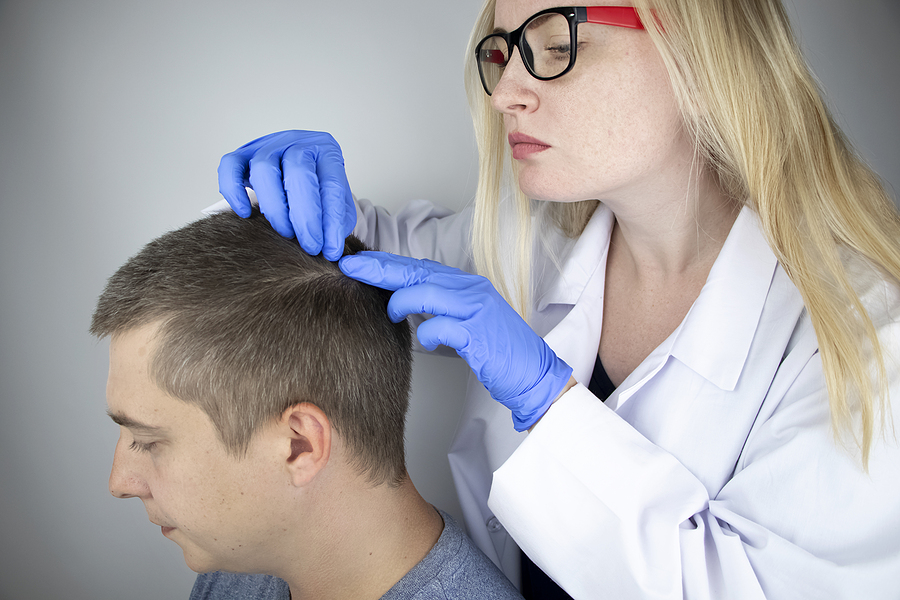 Lohnt sich eine Haartransplantation Auf diese Aspekte ist zu achten!